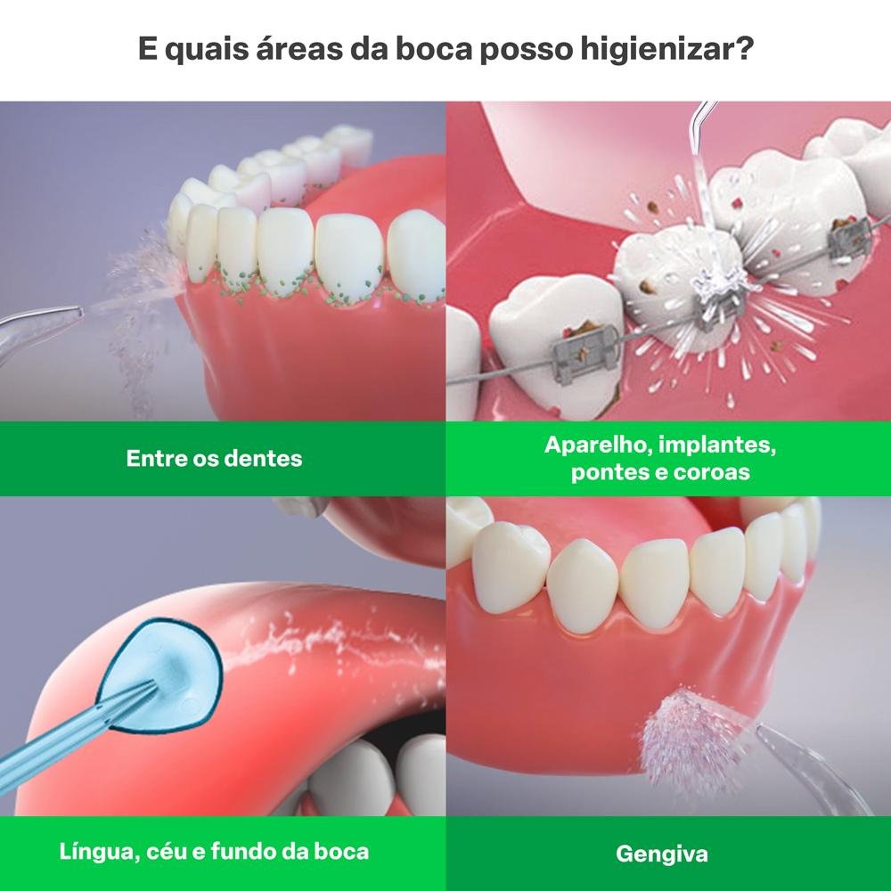 Bicos para Irrigador Oral Clearpik Personal 5 unidades Multi Saude - HC259